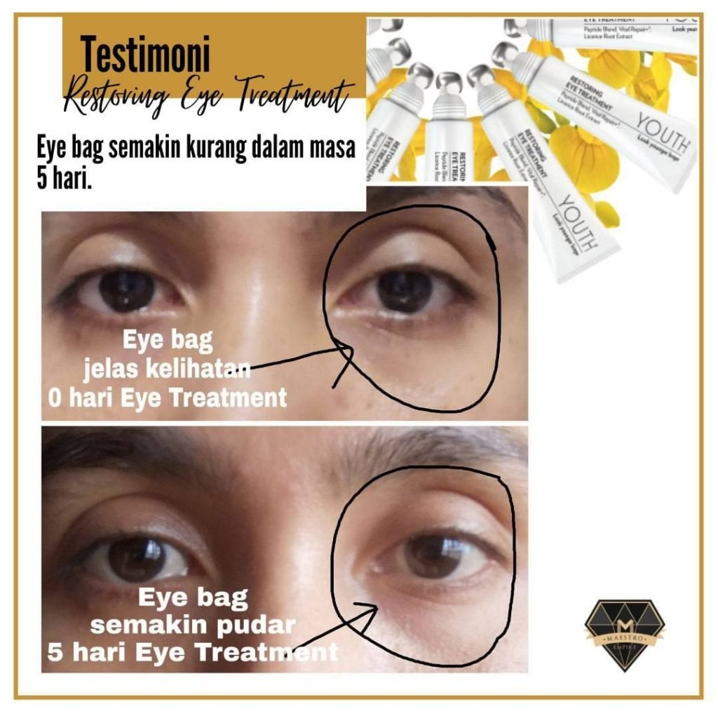 testimoni youth restoring eye treatment shaklee