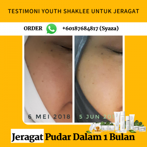 Testimoni YOUTH Shaklee Untuk Masalah Kulit Jeragat Berjeragat